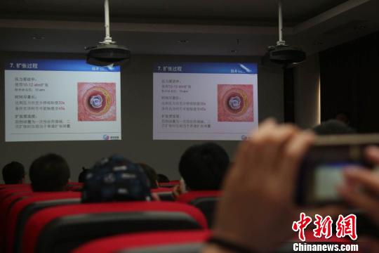 圖為民眾了解冠脈藥物球囊“輕舟？藥物球囊”的功效知識?！＄娦?攝