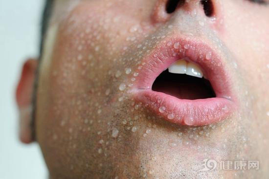 很容易出汗？暗示身體“故障”了！