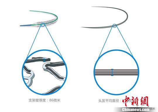 火鷹支架壁的凹槽與頭發(fā)直徑對(duì)比圖?！」﹫D 攝